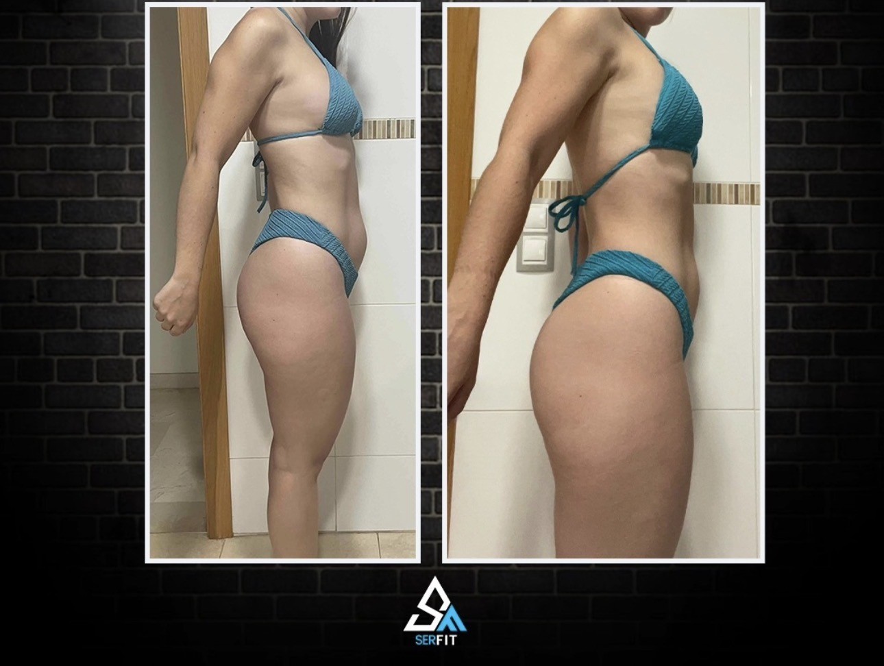 Antes y después lateral — Cliente 6