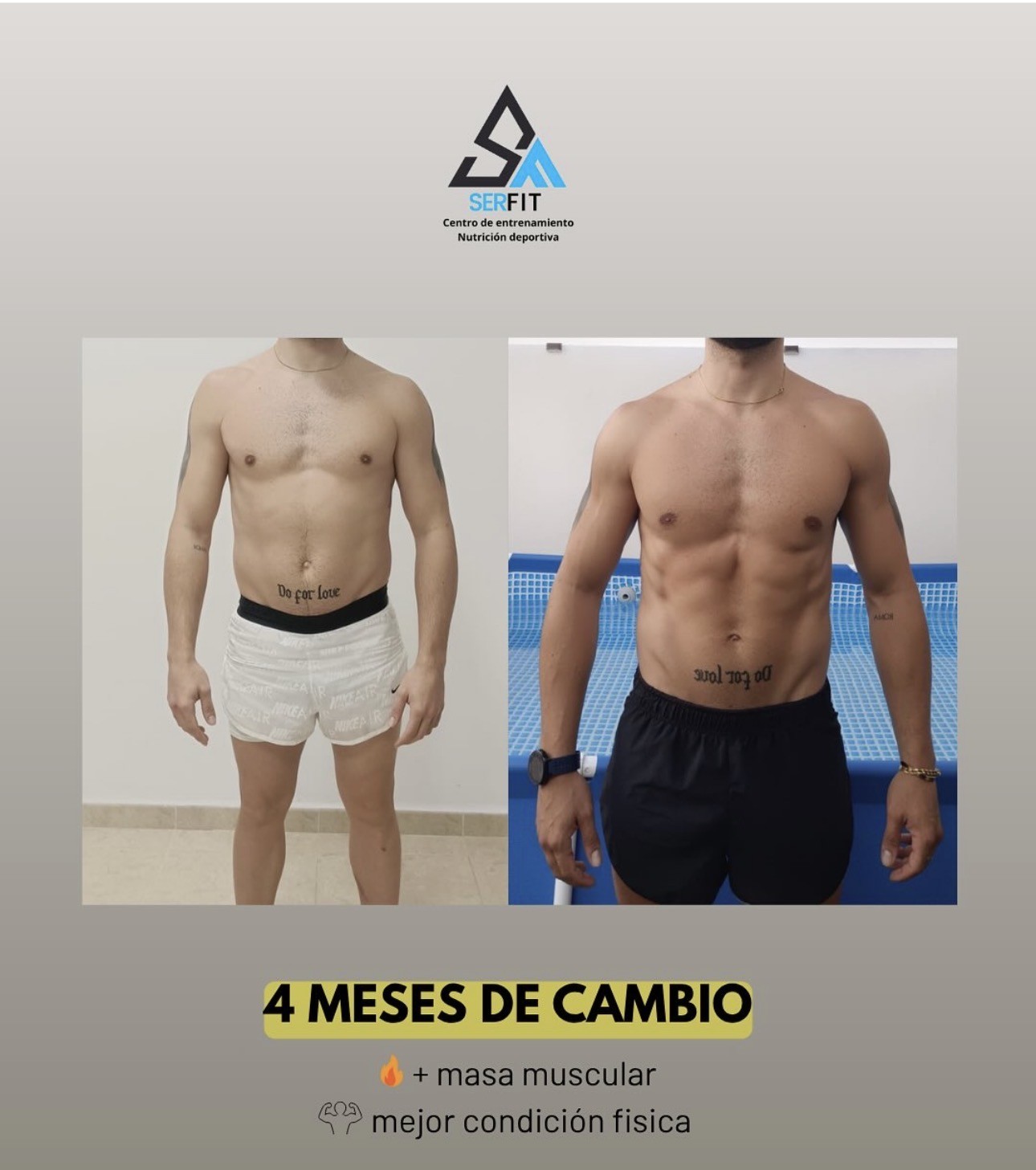 Antes y después frontal — Cliente 2