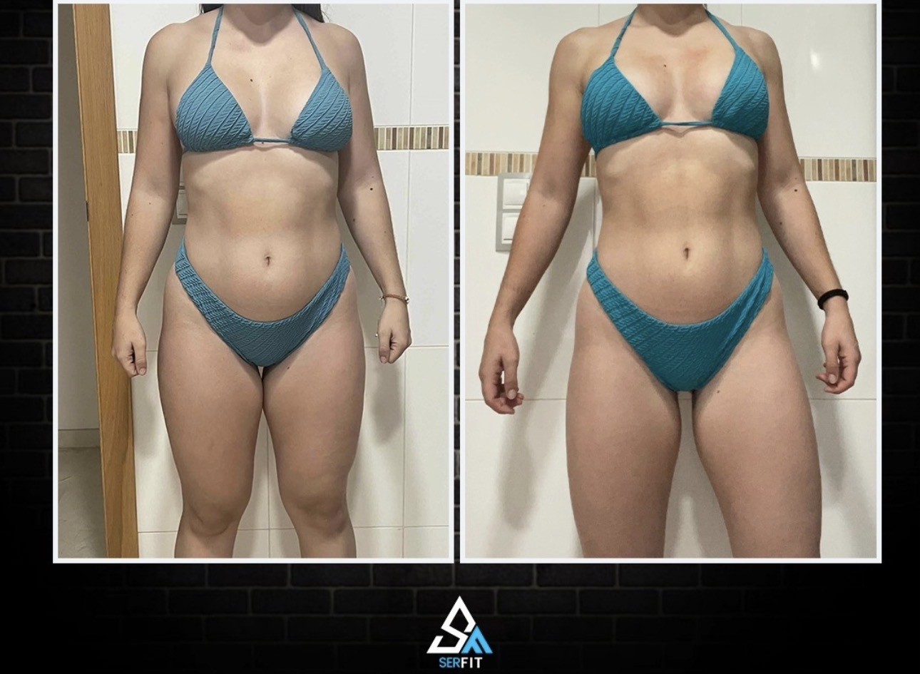 Antes y después frontal — Cliente 6