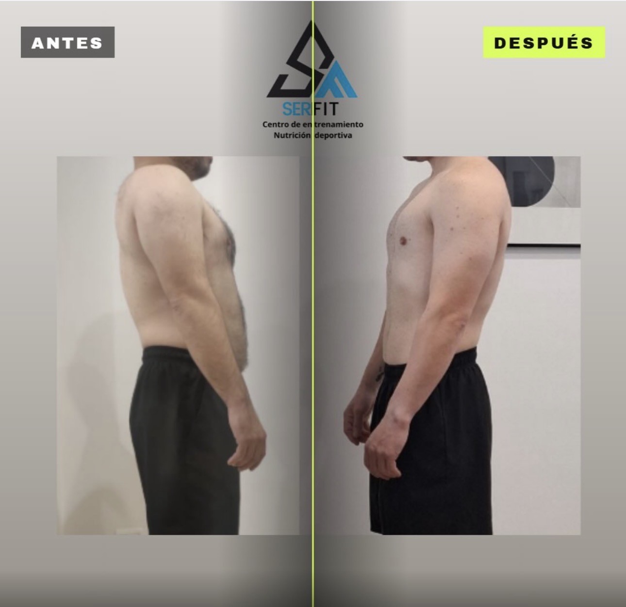 Antes y después de perfil — Cliente 1